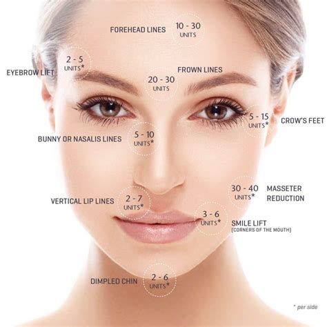 Botox unit amounts per area. #botox Facial Fillers, Botox Fillers, Dermal Fillers, Lip Fillers ...