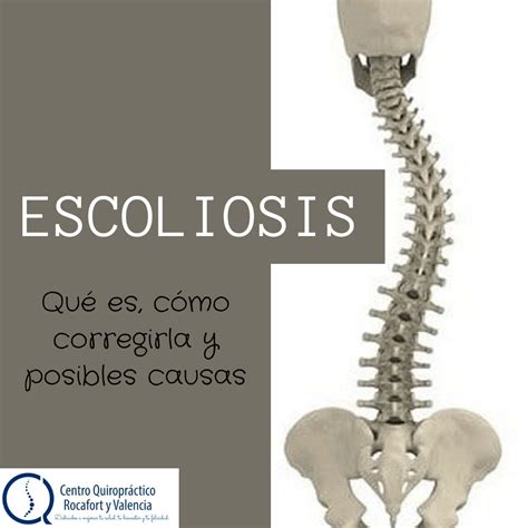 La escoliosis: qué es, cómo mejorarla y posibles causas.