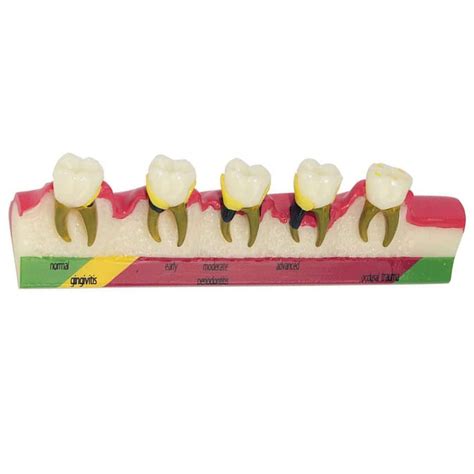 Buy YZDKJDZ Tooth Teeth Typodont Study Teaching Model - Dental ...