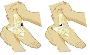 Posterior Drawer Test Ankle