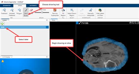 Image result for Volume Segmenter MATLAB Tutorial
