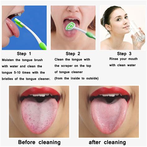 Tongue Brush, Tongue Scraper, Tongue Cleaner, Tongue Philippines | Ubuy