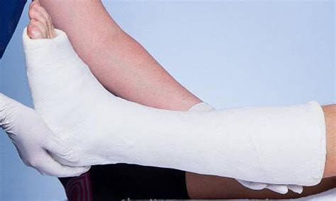 Bandage 的图像结果