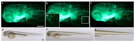 Modeling Lung Carcinoids with Zebrafish Tumor Xenograft