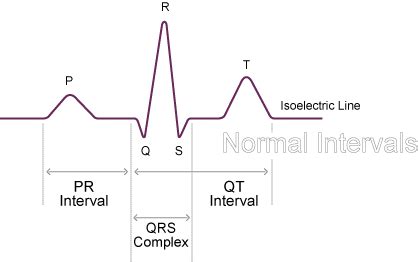 Image result for PR Interval Normal Range