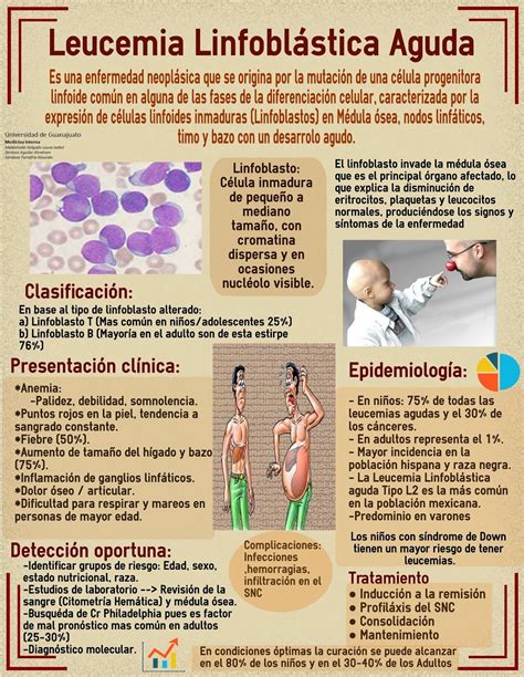 Leucemia Linfoblástica Aguda