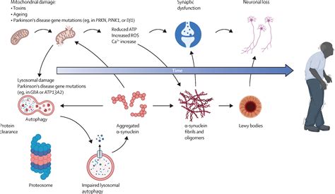 Parkinson Immune Dysfunction – Parkinson’S Disease Neurohistology – YZIP - mechanism of parkinson's disease