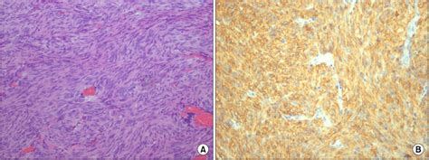 Spindle Shape 的图像结果