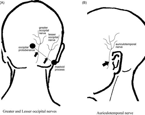 Lesser Occipital Nerve Distribution
