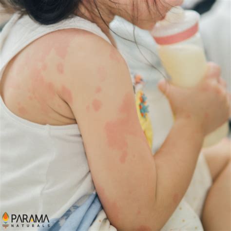 Save Yourself and Save Mother Earth from Chemical-Based skincare ...