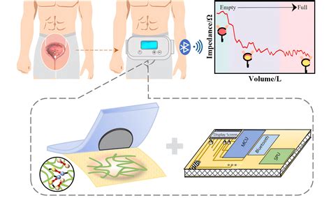 A biocompatible integrated bladder electronics for wireless capacity monitoring assessment