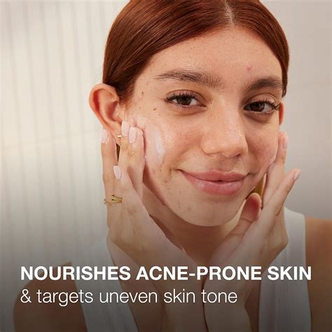 Neutrogena Ultra Gentle Hydrator for Acne-Prone India | Ubuy
