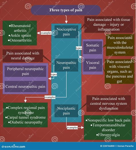 Pain has three basic types stock illustration. Illustration of pain ...