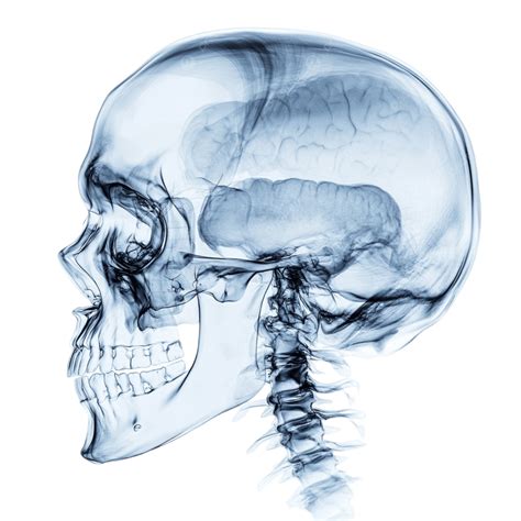 X Ray Skull Anatomy Free Sinister Skull X Ray Image | Download At