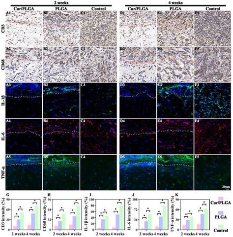 The Immunosuppressive Niche Established with a Curcumin-Loaded ...