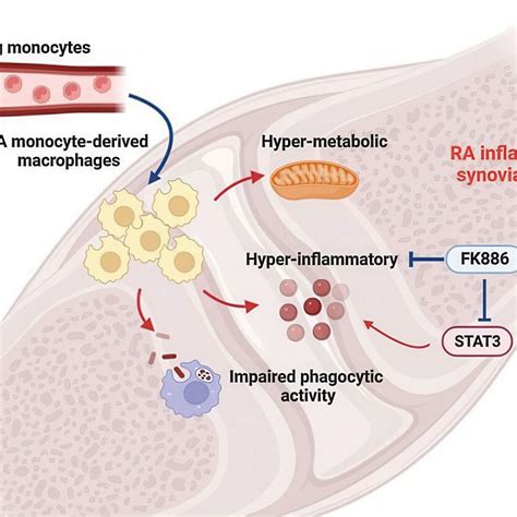 Makrophagen bei rheumatoider Arthritis: Welche Rolle spielen sie ...