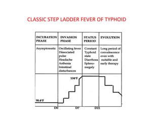 Step Ladder Fever 的图像结果