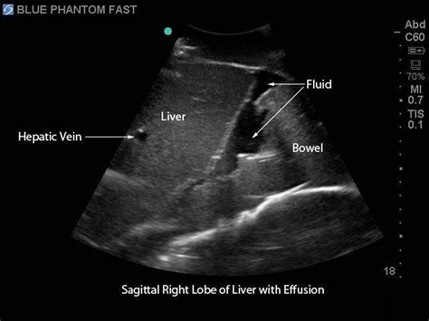FAST Exam Real Time Ultrasound Training Model