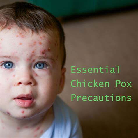 7 Essential Chicken Pox Precautions Every Family Should Know – RiiRoo