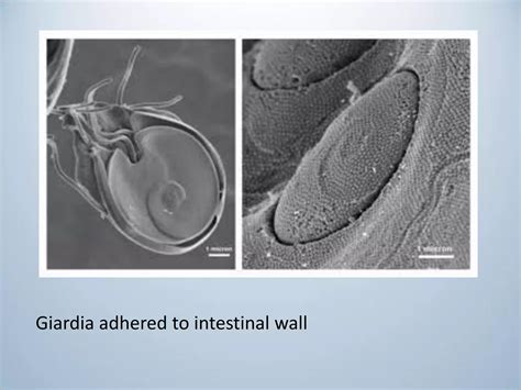 Classification of flagellates and giardia lamblia | PDF