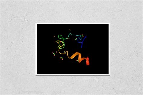 Buy KwikMedia Reproduction of Factor IX (Christmas Factor), one of The ...