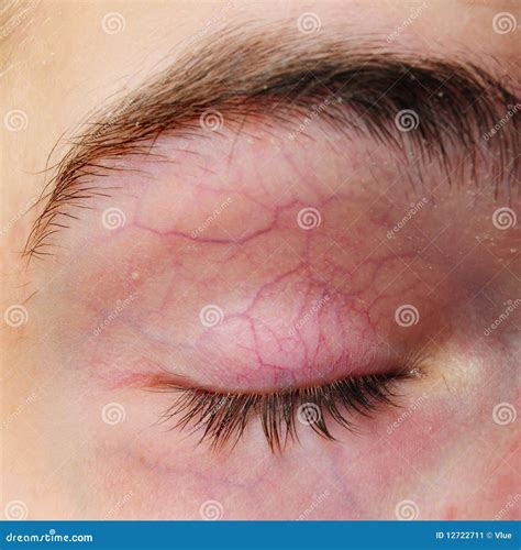 Eyelid With Blood Vessels Veins Royalty-Free Stock Photography | CartoonDealer.com #12722711