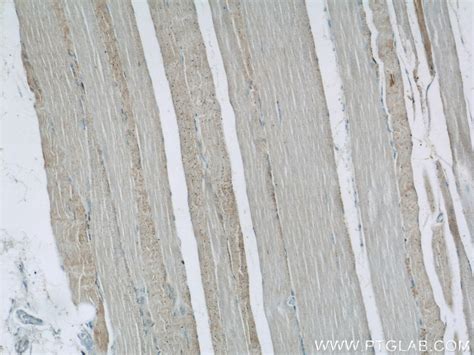 Twinkle/PEO1 antibody (18793-1-AP) | Proteintech