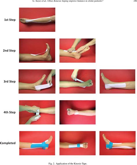 Peroneal Tendonitis Taping