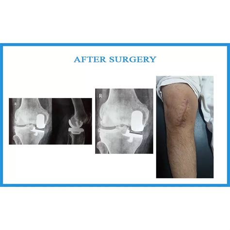 Vora - Dr Samir Nanavati