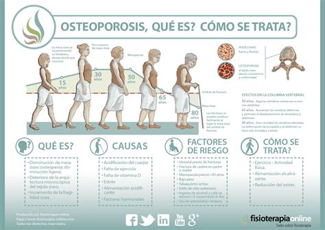 Descubre qué es y cómo se trata la osteoporosis u osteopenia | FisioOnline