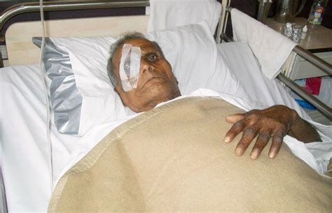Haryana Hospital Botches Cataract Operations And Puts 38 Patients At ...