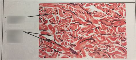 Classification of Tissues 的图像结果