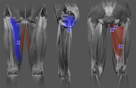 Acupuncture for Vastus Medialis Pain — Morningside Acupuncture NYC