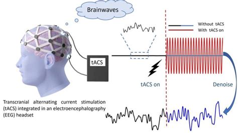 Transcranial Alternating Current Stimulation 的图像结果