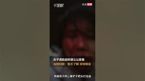 妇联回应女子被公公家暴致满脸血 - YouTube