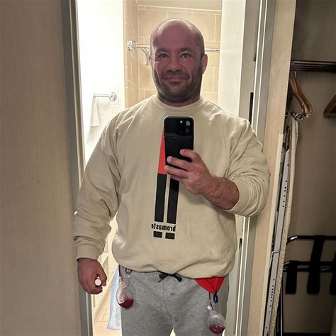 Michael Israetel | Surgery done! I had a ton of loose skin on my lower ...