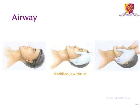 PPT - Neurological emergencies PowerPoint Presentation, free download ...