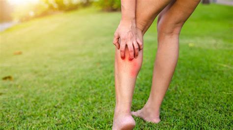 Stinging Insects: 10 of the Most Painful Insect Stings in the World - A ...