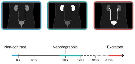 Image result for CT Cystogram vs Urogram