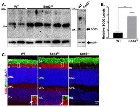 Modulation of SOD3 Levels Is Detrimental to Retinal Homeostasis