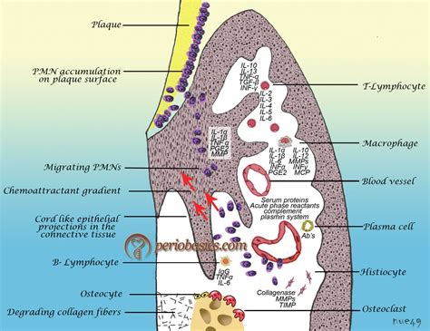 Periodontal pocket – periobasics.com