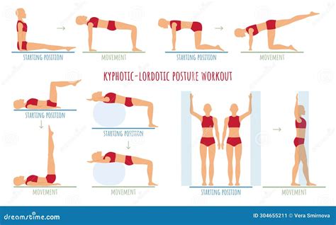 Woman Doing Exercises for Kyphotic Lordotic Posture Rehabilitation. Educational Instructions for ...