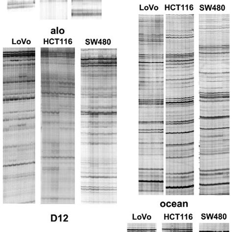 DNA Fingerprinting Examples 的图像结果