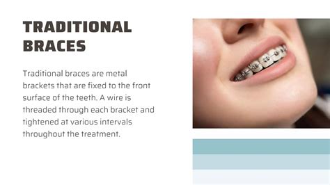 Pros and Cons of Invisalign and Traditional Braces | PPTX