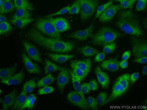 GILZ antibody (12352-1-AP) | Proteintech