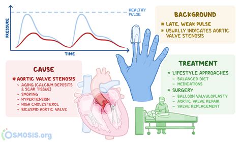 Pulsus parvus et tardus: What Is It, Causes, and More | Osmosis