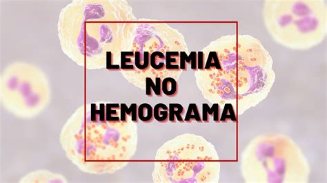 Como identificar Leucemia no Hemograma