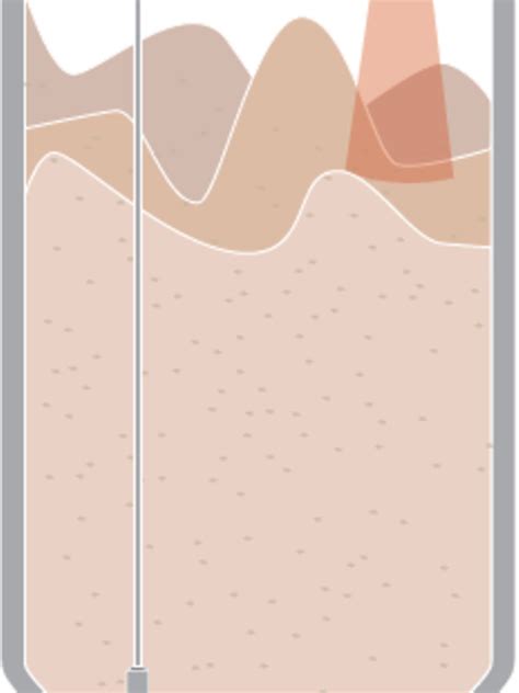 Level Measurement of Corn Surge Bins in Grain Production Operations ...