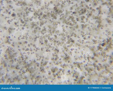 Candida Albicans Under the Microscope Stock Image - Image of medium ...