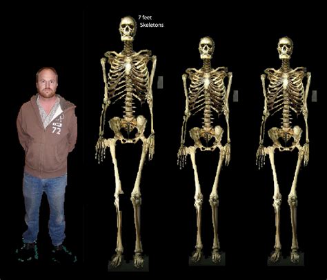 Image result for Skeleton Brain Exploding